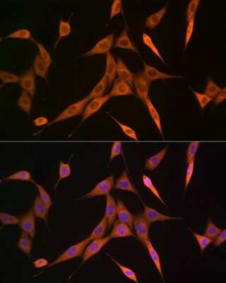 Immunocytochemistry/ Immunofluorescence RhoC Antibody (7X5I9)