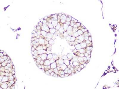 Immunohistochemistry-Paraffin RhoC Antibody (7X5I9)