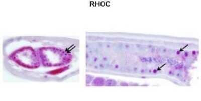 Immunohistochemistry: RhoC Antibody [NBP1-58351] - Brugia malayi intestinal cross section Primary Antibody Dilution: 1 : 200 Secondary Antibody: Anti-rabbit-AP Secondary Antibody Dilution: 1 : 5000 Gene name: RHOC Submitted by: Peter U. Fischer, Ph. D. , Research Associate Professor, Washington University School of Medicine, Infectious Disease Division, Campus Mailbox 8051, 660 S. Euclid Ave, St. Louis, MO 63110 USA, Tel 314-454-7876 Fax 314-454-5293.