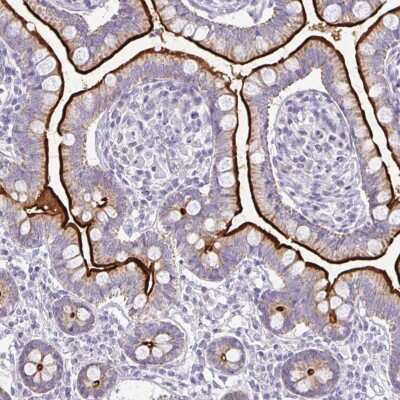 Immunohistochemistry: RhoC Antibody [NBP2-38651] - Staining of human small intestine shows strong cytoplasmic and membranous positivity in glandular cells.