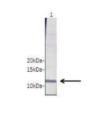 Western Blot: RhoC Antibody [NBP1-58351] - Lanes: Lane 1 : 20 ug of Brugia malayi total worm extract Primary Antibody Dilution: 1 : 1000 Secondary Antibody: Anti-rabbit-HRP Secondary Antibody Dilution: 1 : 5000 Gene name: RHOC Submitted by: Peter U. Fischer, Washington University School of Medicine.