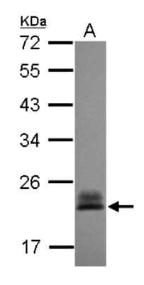 Western Blot: RhoC Antibody [NBP2-20156] - Sample (30 ug of whole cell lysate) A: A431 12% SDS PAGE gel, diluted at 1:3000.