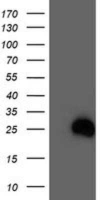 Western Blot: RhoD Antibody (OTI2F7) - Azide and BSA Free [NBP2-73889] - HEK293T cells were transfected with the pCMV6-ENTRY control (Left lane) or pCMV6-ENTRY RhoD (Right lane) cDNA for 48 hrs and lysed. Equivalent amounts of cell lysates (5 ug per lane) were separated by SDS-PAGE and immunoblotted with anti-RhoD.