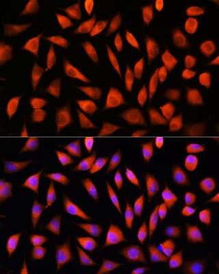 Immunocytochemistry/ Immunofluorescence RhoG Antibody - Azide and BSA Free