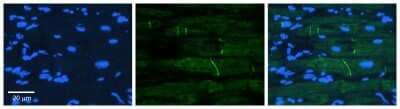 Immunohistochemistry: RhoG Antibody [NBP1-79794] - Formalin Fixed Paraffin Embedded Tissue: Human heart Tissue Observed Staining: Plasma membrane in intercalated disk Primary Antibody Concentration: N/A Other Working Concentrations: 1:600 Secondary Antibody: Donkey anti-Rabbit-Cy3 Secondary Antibody Concentration: 1:200 Magnification: 20X Exposure Time: 0.5 - 2.0 sec