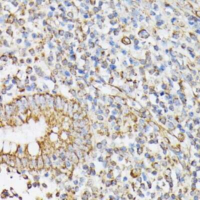 Immunohistochemistry-Paraffin: RhoG Antibody [NBP3-15747] - Immunohistochemistry of paraffin-embedded human appendix using RhoG antibody (NBP3-15747) at dilution of 1:100 (40x lens).Perform microwave antigen retrieval with 10 mM PBS buffer pH 7.2 before commencing with IHC staining protocol.