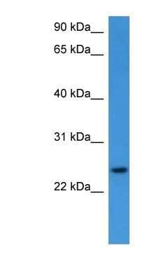 Western Blot: RhoG Antibody [NBP1-79794] - Jurkat cell lysate, concentration 0.2-1 ug/ml.