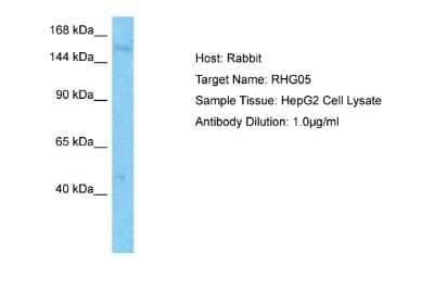 Western Blot: RhoGAP Antibody [NBP2-88152] - Host: Rabbit. Target Name: RHG05. Sample Type: HepG2 Whole Cell lysates. Antibody Dilution: 1.0ug/ml