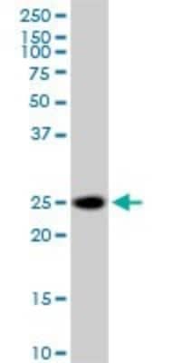 Western Blot: RhoGDI Antibody [H00000396-B02P] - Analysis of ARHGDIA expression in Jurkat.