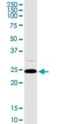 Western Blot: RhoGDI Antibody [H00000396-D03P] - Analysis of ARHGDIA expression in Jurkat.