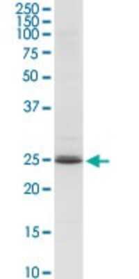 Western Blot: RhoGDI Antibody [H00000396-D03P] - Analysis of ARHGDIA expression in human spleen.