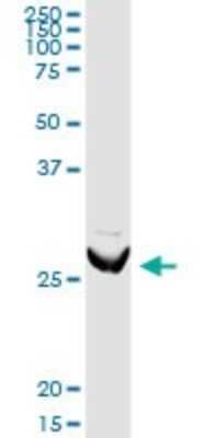 Western Blot: RhoGDI Antibody [H00000396-D03P] - Analysis of ARHGDIA expression in mouse stomach.
