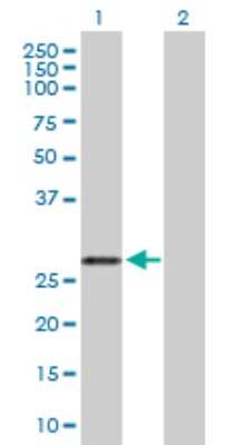 Western Blot: RhoGDI Antibody [H00000396-D03P] - Analysis of ARHGDIA expression in transfected 293T cell line by ARHGDIA polyclonal antibody.Lane 1: ARHGDIA transfected lysate(22.55 KDa).Lane 2: Non-transfected lysate.