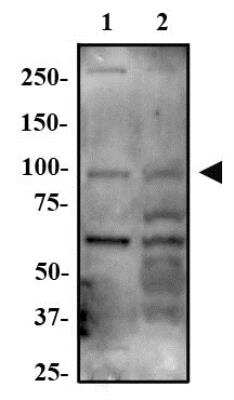 Western Blot: ARHGAP12 Antibody [NBP2-23690] - Whole cell protein from A549 (lane 1), MCF7 (lane 2) and HepG2 (lane 3) was separated on a 7.5% gel by SDS-PAGE, transferred to PVDF membrane and blocked in 5% non-fat milk in TBST. The membrane was probed with a 1:500 dilution of anti-RhoGap12 in 1% milk and detected with an anti-rabbit HRP secondary antibody using chemiluminescence.