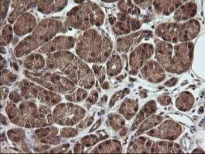 Immunohistochemistry: RhoJ Antibody (OTI1D7) [NBP2-45590] - Analysis of Human pancreas tissue.