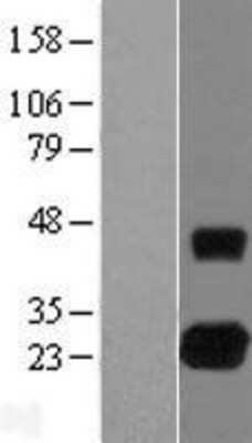 Western Blot RhoJ Overexpression Lysate