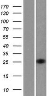 Western Blot: RhoV Overexpression Lysate (Adult Normal) [NBP2-05695] Left-Empty vector transfected control cell lysate (HEK293 cell lysate); Right -Over-expression Lysate for RhoV.