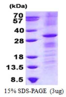 SDS-Page: RhoV Protein [NBP2-23400]