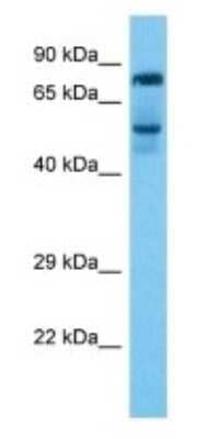 Western Blot: Rhophilin 2 Antibody [NBP3-09401] - Western blot analysis of Rhophilin 2 in Liver Tumor. Antibody dilution at 1.0ug/ml
