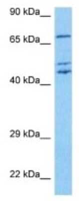Western Blot: Rhophilin 2 Antibody [NBP3-10020] - Western blot analysis of Rhophilin 2 in Human U937 Whole Cell lysates. Antibody dilution at 1ug/ml