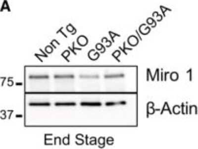 Western Blot: Rhot1 Antibody (4H4) [H00055288-M01] - Parkin knockout improves the decline of mitochondrial dynamics proteins in SOD1-G93A spinal cord, but mitochondrial protein ubiquitination profiles and March5 and Mul1 levels are unaffected A, B Western blots (A) and quantification (B) of Miro1 in spinal cord homogenates at disease end stage. Beta-actin is used as loading reference. Image collected and cropped by CiteAb from the following publication (//embomolmed.embopress.org/lookup/doi/10.15252/emmm.201808888) licensed under a CC-BY license.