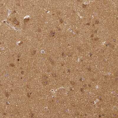 Immunohistochemistry-Paraffin: Rhot1 Antibody (CL1083) [NBP2-52964] - Staining of human cerebral cortex shows moderate to strong cytoplasmic positivity in neuronal cells, as well as positivity in neuropil.