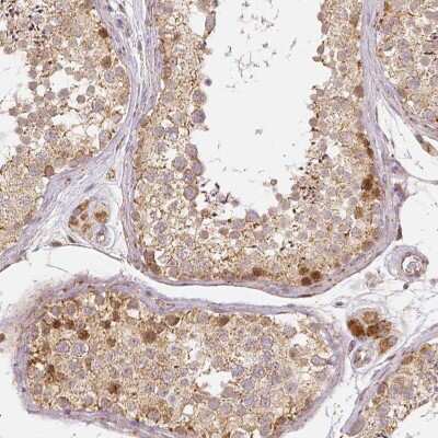 Immunohistochemistry-Paraffin: Rhot1 Antibody (CL1083) [NBP2-52964] - Staining of human testis shows moderate cytoplasmic positivity in cells in seminiferous ducts.