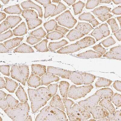 Immunohistochemistry-Paraffin: Rhot1 Antibody (CL1083) [NBP2-52964] - Staining of human skeletal muscle shows weak cytoplasmic positivity in striated muscle fibers.