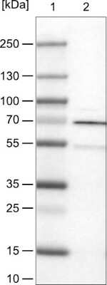 Western Blot: Rhot1 Antibody (CL1083) [NBP2-52964] - Lane 1: Marker [kDa], Lane 2: Human cerebral cortex