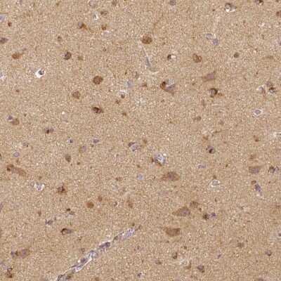 Immunohistochemistry-Paraffin: Rhot1 Antibody (CL1095) [NBP2-52965] - Staining of human cerebral cortex shows moderate to strong cytoplasmic positivity in neuronal cells, as well as positivity in neuropil.