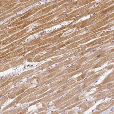 Immunohistochemistry-Paraffin: Rhot1 Antibody (CL1095) [NBP2-52965] - Staining of human heart muscle shows moderate cytoplasmic positivity in cardiomyocytes.