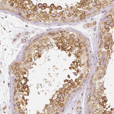 Immunohistochemistry-Paraffin: Rhot1 Antibody (CL1095) [NBP2-52965] - Staining of human testis shows moderate cytoplasmic positivity in cells in seminiferous ducts.