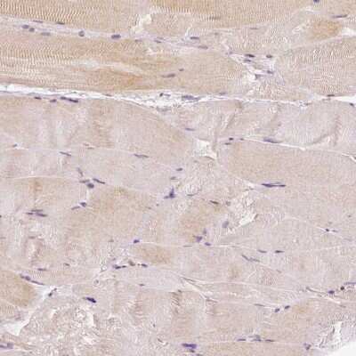 Immunohistochemistry-Paraffin: Rhot1 Antibody (CL1095) [NBP2-52965] - Staining of human skeletal muscle shows only very weak cytoplasmic positivity in striated muscle fibers.