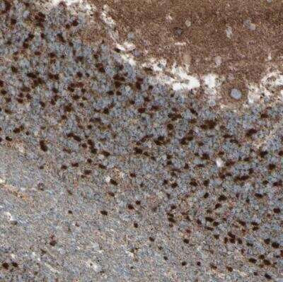 Immunohistochemistry-Paraffin: Rhot1 Antibody [NBP1-89011] - Staining of human cerebellum shows positivity in neuronal cells.