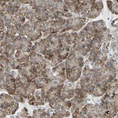 Immunohistochemistry-Paraffin: Rhot1 Antibody [NBP1-89011] - Staining of human pancreas shows positivity in exocrine glandular cells.