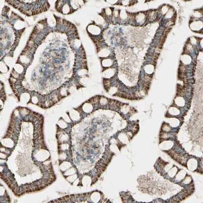 Immunohistochemistry-Paraffin: Rhot1 Antibody [NBP1-89011] - Staining of human small intestine shows  positivity in glandular cells.