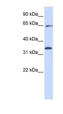 Western Blot: Rhot1 Antibody [NBP1-59022] - Hela cell lysate, concentration 0.2-1 ug/ml.