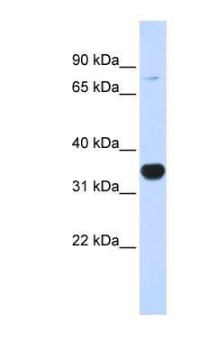 Western Blot: Rhot1 Antibody [NBP1-59609] - 293T cells lysate, concentration 0.2-1 ug/ml.