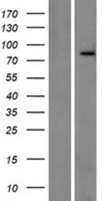 Western Blot: Rhot1 Overexpression Lysate (Adult Normal) [NBP2-08624] Left-Empty vector transfected control cell lysate (HEK293 cell lysate); Right -Over-expression Lysate for Rhot1.