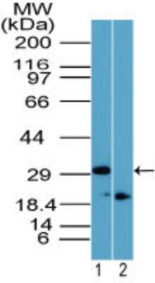 Western Blot: Rhox11 Antibody [NBP2-23830] - Analysis of Rhox-11 in 12 day mouse testis in the 1) absence and 2) presence of immunizing peptide using this antibody. Goat anti-rabbit Ig HRP secondary antibody and PicoTect ECL substrate solution were used for this test.