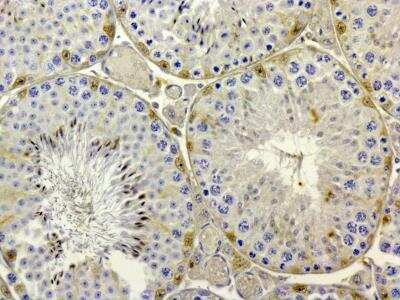 Immunohistochemistry: Rhox8 Antibody [NBP2-23671] - analysis of Rhox8 in Bouins-fixed Mouse testis using anti-Rhox8 antibody. Image from verified customer review.