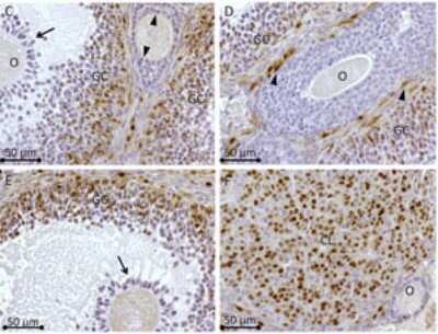 Immunohistochemistry-Paraffin: Rhox8 Antibody [NBP2-23671] - Visualization by diaminobenzidine staining reveals that most of the Rhox-8 protein is localized to granulosa cells of large antral follicles (granulosa cells are shown at higher magnification in C-;F). Weak Rhox-8 protein staining can be observed in some granulosa cells of preantral follicles (C, arrowheads) and is absent in cumulus granulosa cells (C and E, arrows) surrounding the oocyte (O). D) Nuclei of thecal cells (arrowheads) are also positive for Rhox-8. F) Rhox-8 expression remains in the corpus luteum (CL) of postovulatory follicles.