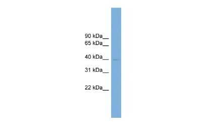 Western Blot Rhox8 Antibody