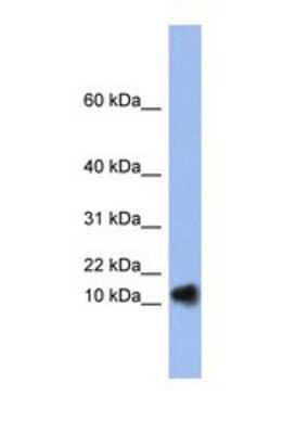 Western Blot: Ribonuclease A Antibody [NBP1-69257] - This Anti-RNASE1 antibody was used in Western Blot of Fetal Spleen   tissue lysate at a concentration of 1ug/ml.