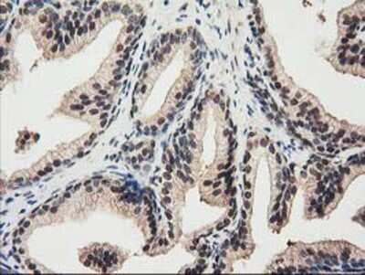 Immunohistochemistry-Paraffin: Ribonuclease Inhibitor Antibody (1B7) [NBP2-03254] - Staining of paraffin-embedded Human prostate tissue using anti-Ribonuclease Inhibitor mouse monoclonal antibody.