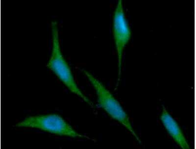 Immunocytochemistry/Immunofluorescence: Ribonuclease Inhibitor Antibody (1H23) [NBP1-30167] - Analysis of RNH1 in PC3 cells line, stained with DAPI (Blue) for nucleus staining and monoclonal anti-human RNH1 antibody (1:100) with goat anti-mouse IgG-Alexa fluor 488 conjugate (Green).