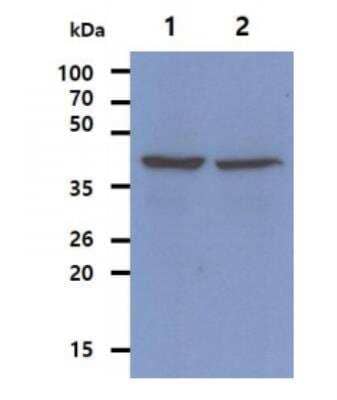 Western Blot: Ribonuclease Inhibitor Antibody (1H23) [NBP1-30167] - The Cell lysates (40ug) were resolved by SDS-PAGE, transferred to PVDF membrane and probed with anti-human RNH1 antibody (1:500). Proteins were visualized using a goat anti-mouse secondary antibody conjugated to HRP and an ECL detection system. Lane 1. : Jurkat cell lysate Lane 2. : HepG2 cell lysate