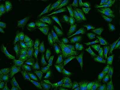 Immunocytochemistry/Immunofluorescence: Ribonuclease Inhibitor Antibody [NBP2-99628] - Immunofluorescence staining of Ribonuclease Inhibitor in U2OS cells. Cells were fixed with 4% PFA, permeabilzed with 0.1% Triton X-100 in PBS, blocked with 10% serum, and incubated with rabbit anti-human Ribonuclease Inhibitor polyclonal antibody (dilution ratio 1:1000) at 4C overnight. Then cells were stained with the Alexa Fluor(R)488-conjugated Goat Anti-rabbit IgG secondary antibody (green) and counterstained with DAPI (blue).Positive staining was localized to Cytoplasm.