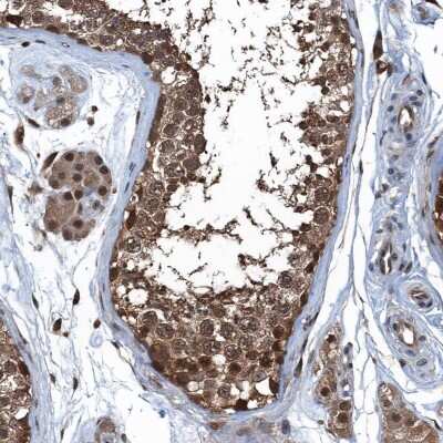 Immunohistochemistry-Paraffin: Ribonuclease Inhibitor Antibody [NBP1-87162] - Staining of human testis shows strong cytoplasmic and nuclear positivity in cells in seminiferous tubules.