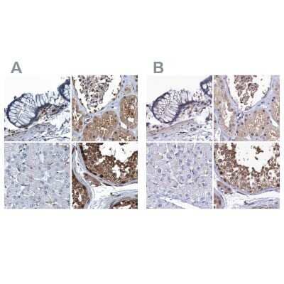 <b>Independent Antibodies Validation. </b>Immunohistochemistry-Paraffin: Ribonuclease Inhibitor Antibody [NBP1-87162] - Staining of human colon, kidney, liver and testis using Anti-RNH1 antibody NBP1-87162 (A) shows similar protein distribution across tissues to independent antibody NBP1-87161 (B).